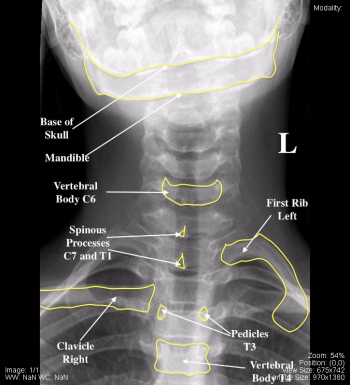 Pediatric – Undergraduate Diagnostic Imaging Fundamentals