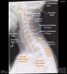 Head and Neck – Undergraduate Diagnostic Imaging Fundamentals