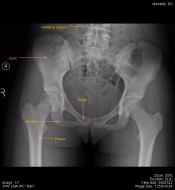 Musculoskeletal – Undergraduate Diagnostic Imaging Fundamentals