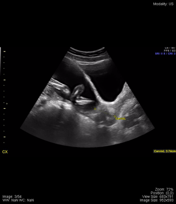 Pelvis – Undergraduate Diagnostic Imaging Fundamentals