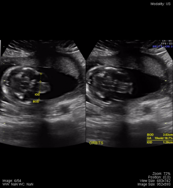 Pelvis – Undergraduate Diagnostic Imaging Fundamentals