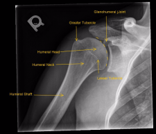 Musculoskeletal – Undergraduate Diagnostic Imaging Fundamentals