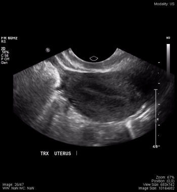 Pelvis – Undergraduate Diagnostic Imaging Fundamentals