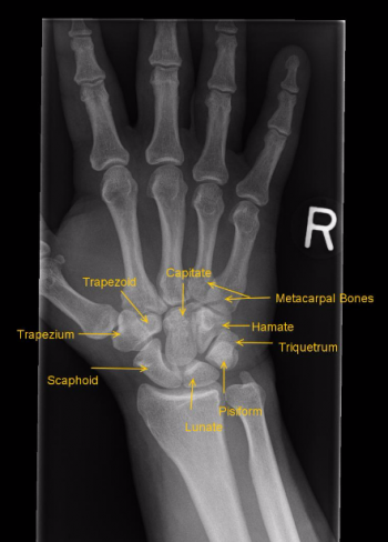 Musculoskeletal – Undergraduate Diagnostic Imaging Fundamentals