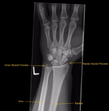 Musculoskeletal – Undergraduate Diagnostic Imaging Fundamentals