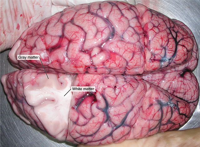 Photo of a human brain, with a section cut out to show the darker outer layer, the grey matter, and the inner white matter.